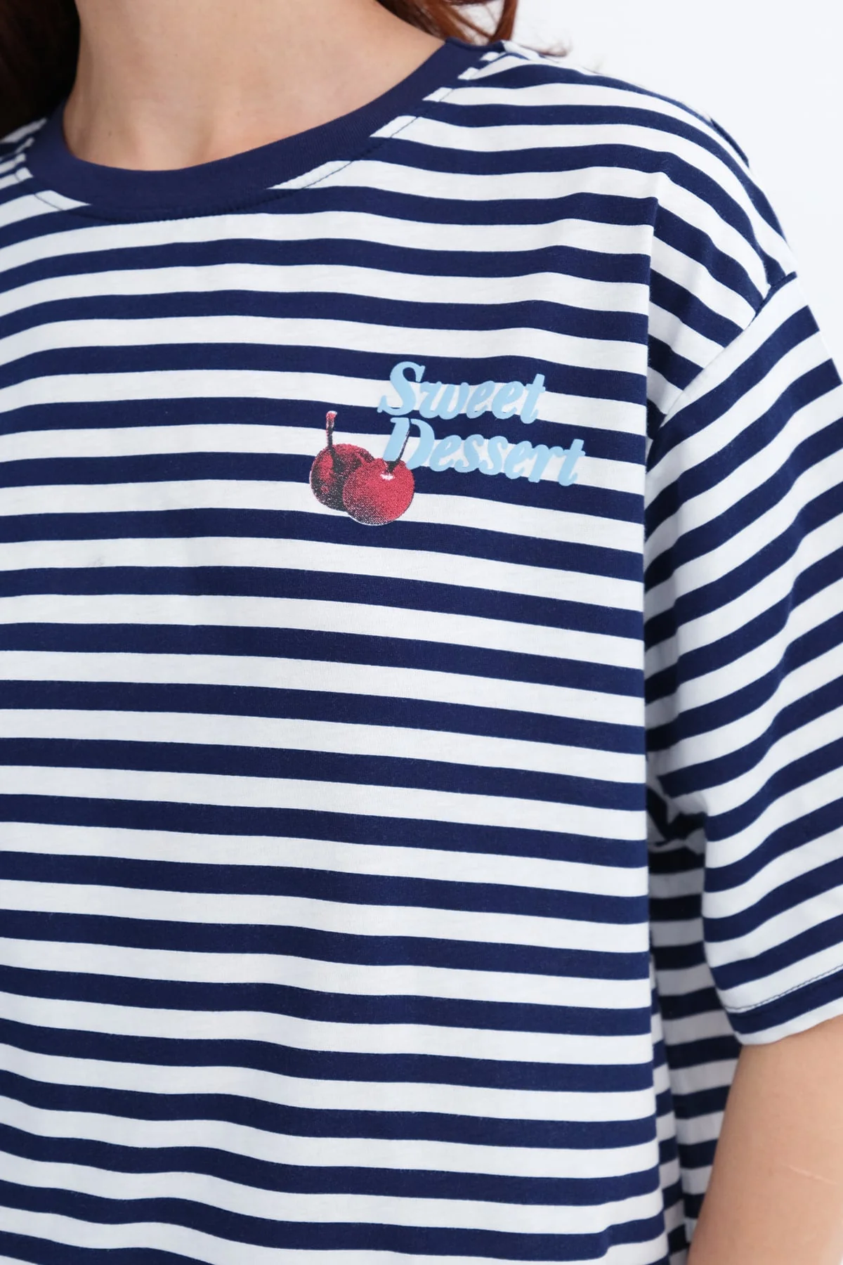 Striped Cherry T-shirt - Image 5